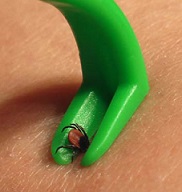 tick-removal